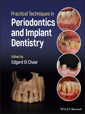 cover image of Practical Techniques in Periodontics and Implant Dentistry